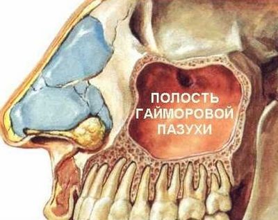 Cum sa scapi de dureri de cap cu geniezita - Health Info