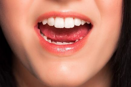 Cum să-ți întărești dinții în cazul în care se sclipesc - la domiciliu și la stomatologie