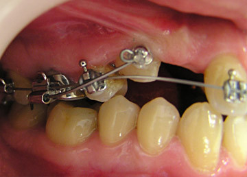 Cazuri clinice de tratament ortodontic