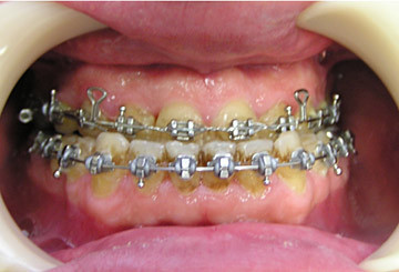 Cazuri clinice de tratament ortodontic