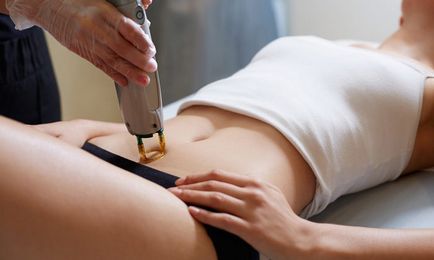 Epilarea cu laser a zonei de bikini (adâncime, extra) este procedura dăunătoare, este dureroasă, consecințele în