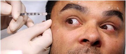 Metode pentru eliminarea ridurilor pe frunte, cosmetologie