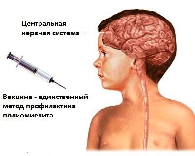 Чи можна купати дитину після щеплення поліомієліт, чи можна дитині