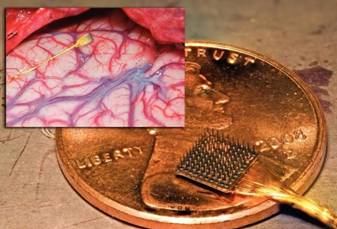 Neural chips, agyi chip implantátumok és az agy-gép interfész programot ( «brain-gép