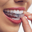 Новинки в області відбілювання зубів