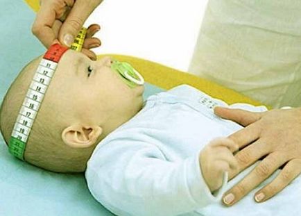 Окружність голови новонародженого яка норма і як виміряти окружність голови новонародженої дитини