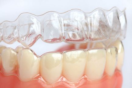 Ortodonția răspunde la întrebările frecvente