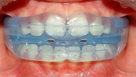Ortodonția răspunde la întrebările frecvente