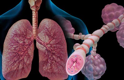 Ускладнення бронхіальної астми чи можна померти і які можуть бути наслідки