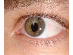 Відшарування сітківки ока лікування - ціна операції