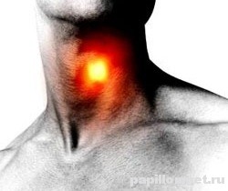 Папіломатоз гортані і мигдалин симптоми, профілактика та лікування