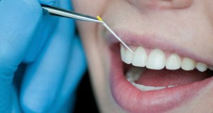 Пародонтит лікування і перші симптоми захворювання - можливо кращий сайт про лікування зубів