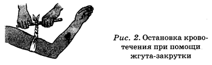 Elsősegély vérzés (első) Elsősegély vérzés