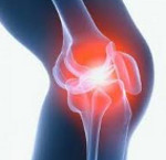 Пошкодження колінного суглоба у дітей - причини, симптоми, діагностика та лікування