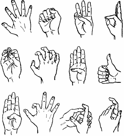 Deteriorarea tendoanelor mâinii și degetelor, Лфк