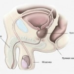 профілактика простатиту