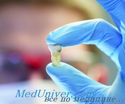 Розфіксацію протеза зуба причини і методи вирішення проблеми