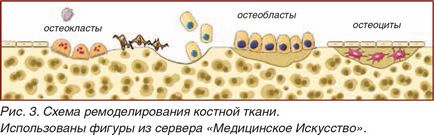 Регенерація кісткової тканини в стоматології