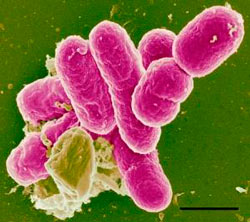 Шигелла Флекснера (shigella flexneri)