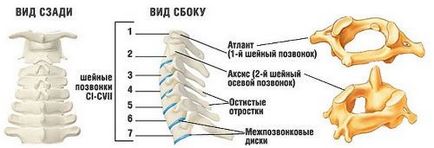 Шина шанца для шиї як вибрати ортопедичний шийний комір, відгуки