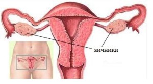 Simptomele, cauzele și tratamentul sindromului epuizării ovarelor