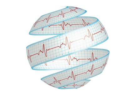 Sindromul de repolarizare precoce a ventriculilor