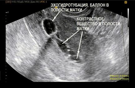 Evaluarea comparativă a metodelor de vizualizare indirectă în practica medicinei reproductive