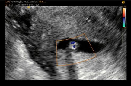 Evaluarea comparativă a metodelor de vizualizare indirectă în practica medicinei reproductive