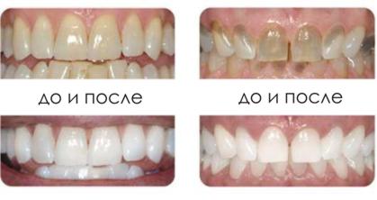 Dentist PMR Tiraspol Bendery