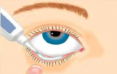 Тетрациклінова мазь для очей - інструкція із застосування