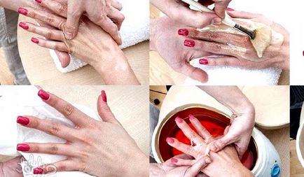 Cracked piele pe degete lângă unghii, cauze și tratament la domiciliu
