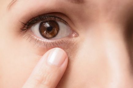 Eliminarea papilomilor pe ochi