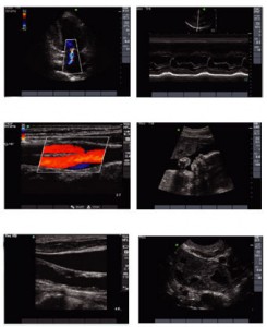 Sistem de diagnosticare cu ultrasunete smartsono ms-08