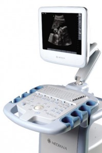 Sistem de diagnosticare cu ultrasunete smartsono ms-08