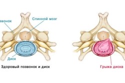 Uzi coloanei vertebrale în ce probleme sunt atribuite, alegerea clinicii (video)