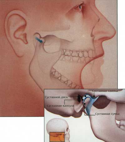Temporomandibular ízületankylosishoz és annak kezelése