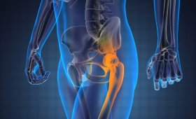 Chondromalarea patellei, articulației genunchiului ce este aceasta?