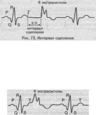 Alfabetul ECG