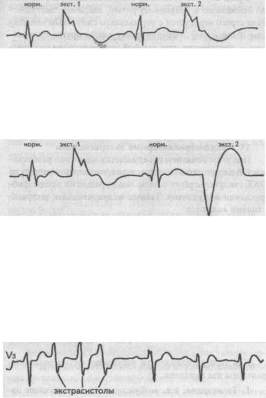 Alphabet EKG