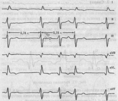 Alphabet EKG