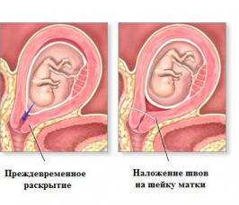 Ce este colul cervical de col uterin
