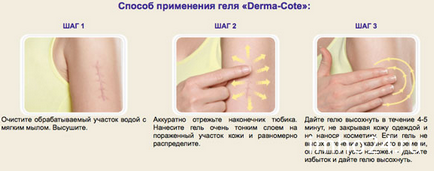 Derma - cote (derma cat) gel din cicatrici, cicatrici și revizii