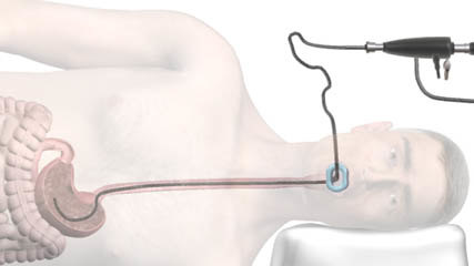 Гастроскопия шлунка показання, підготовка і порядок проведення