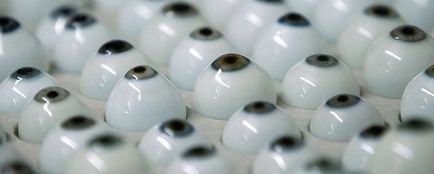 Szemészeti protézis után retinoblasztóma (szemészeti protézis) Szemészeti protézis után retinoblasztóma