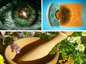 Ce remedii populare pot vindeca cataracta