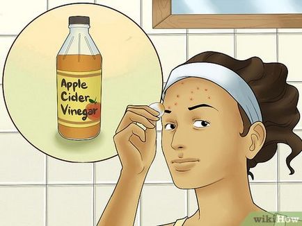 Cum sa scapi de acnee pe frunte