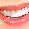 Як можна безболісно видалити зуб