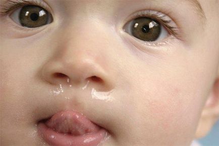 Kalanchoe babák tud csöpögni orra