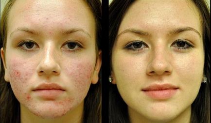 Крем для шкіри обличчя з цинком зволоження, очищення і живлення шкіри