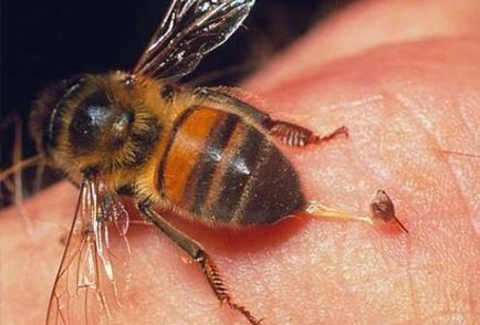 Tratamentul de mușcături de viespi și albine remedii folk